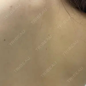 美容皮膚科エルムクリニック 福岡院口コミ