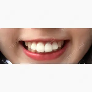 オーラルビューティークリニック クラリス審美歯科・矯正歯科口コミ