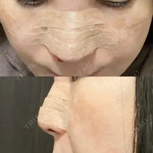 聖心美容クリニック 大阪院口コミ