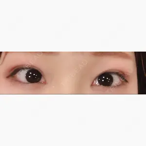 みやざき美容クリニック口コミ