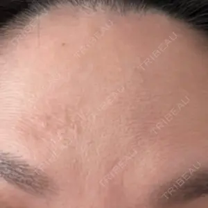 湘南美容クリニック 広島院口コミ