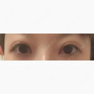 みやび形成外科口コミ