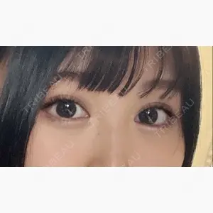 銀座みゆき通り美容外科 東京本院口コミ