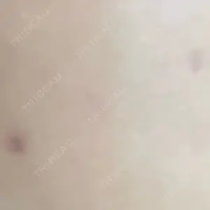 リッツ美容外科 大阪院口コミ