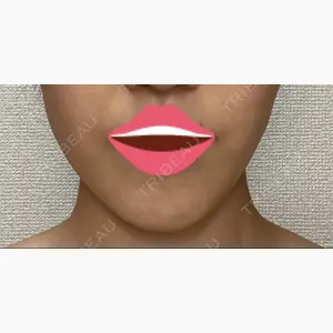 アラジン美容クリニック口コミ