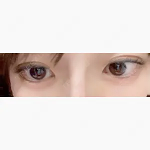 渋谷美容外科クリニック 新橋院口コミ