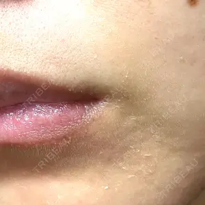 メディスリールクリニック口コミ