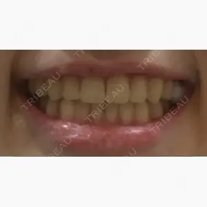 スマイルプランさくら歯科クリニック口コミ