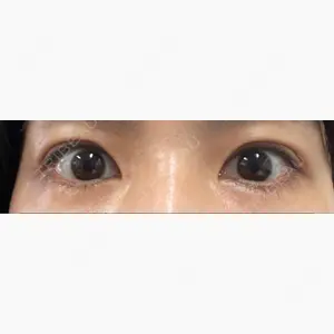 プライム銀座美容クリニック口コミ
