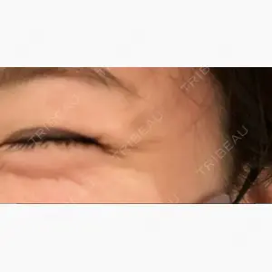 湘南美容クリニック 八王子院口コミ