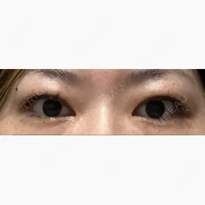 ツツイ美容外科口コミ