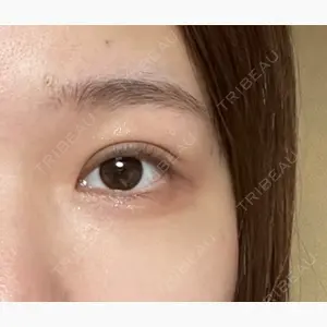 リッツ美容外科 大阪院口コミ