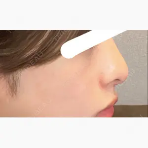 銀座みゆき通り美容外科 大阪梅田院口コミ