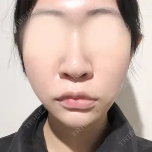 銀座TAクリニック口コミ