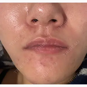 セイコメディカルビューティクリニック 福岡院口コミ