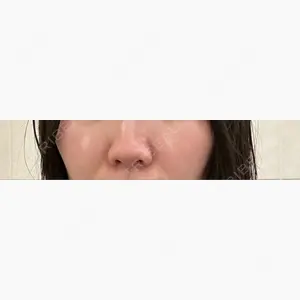 東京シンデレラ美容外科 池袋院口コミ