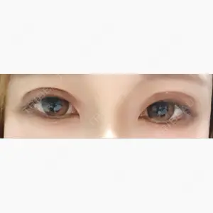 東京イセアクリニック口コミ