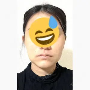 イテウォンビューティークリニック 名古屋栄院口コミ