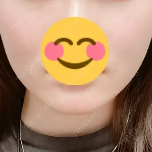 TCB スキンクリニック 大阪駅前院口コミ