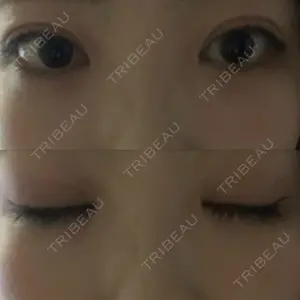 エイペックス美容外科口コミ