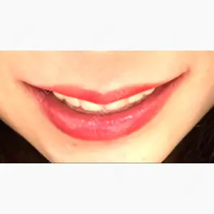 東京銀座A CLINIC デンタル口コミ