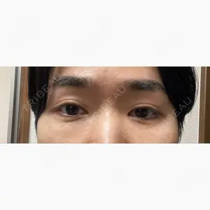 東京イセアクリニック口コミ