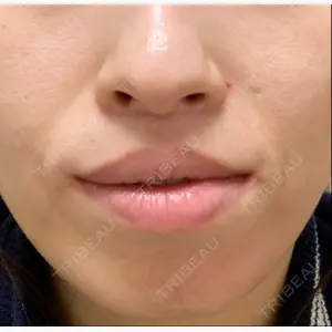 池田クリニック 大阪院口コミ