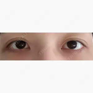 東京イセアクリニック口コミ