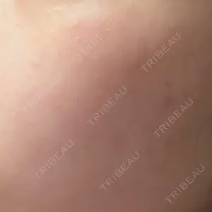 美容皮膚科エルムクリニック 福岡院口コミ