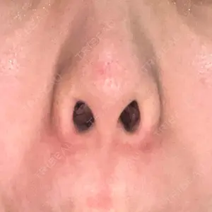 エースクリニック 大阪梅田HEPナビオ院口コミ