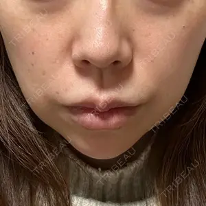 LIFIX BEAUTY CLINIC口コミ