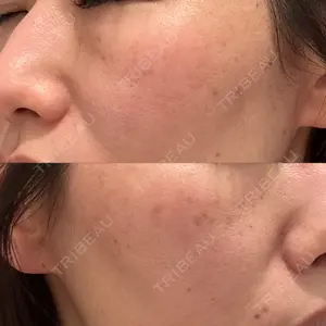 BISIN GINZA CLINIC口コミ