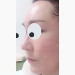 FROM B整形外科 (旧バウム整形外科)口コミ