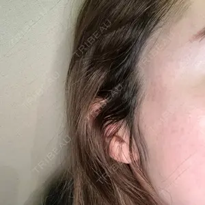 お茶の水美容形成クリニック口コミ