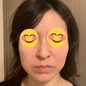 スキンリファインクリニック銀座口コミ