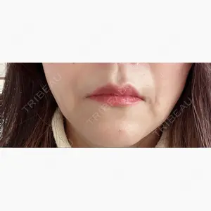 エースクリニック 大阪梅田HEPナビオ院口コミ