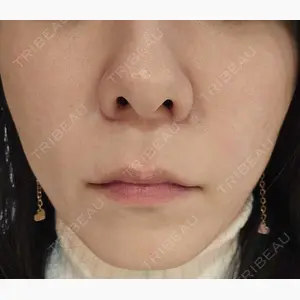 湘南美容クリニック 仙台院口コミ