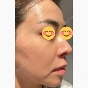 湘南美容クリニック 高崎院口コミ