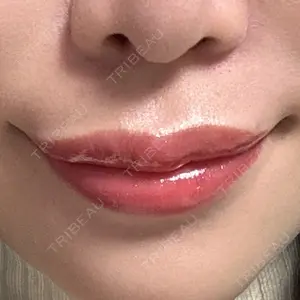 フィロクリニック口コミ