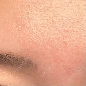 三鷹はなふさ皮膚科口コミ