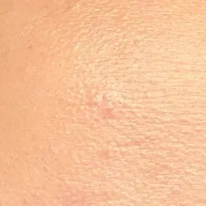 三鷹はなふさ皮膚科口コミ