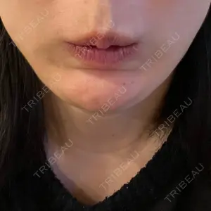 プムクリニック明洞店口コミ