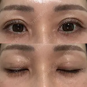 ロレシー美容クリニック 心斎橋駅前院口コミ