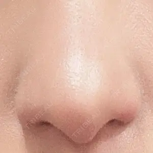 大阪TAクリニック口コミ