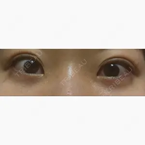 吉井クリニック口コミ