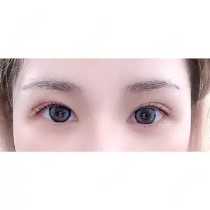BELINDA CLINIC（ベリンダクリニック）岡山院口コミ