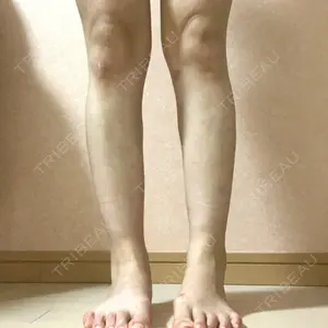 アサミ美容外科 渋谷院口コミ