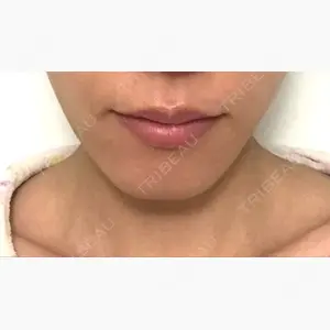MIL CLINIC OSAKA口コミ