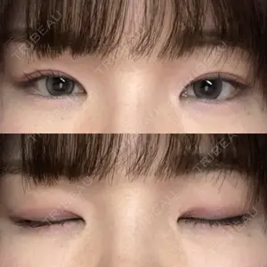水の森美容クリニック 福岡院口コミ