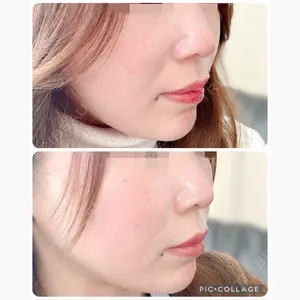 フローラクリニック口コミ